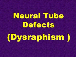 Neural Tube Defects Dysraphism Neural Tube Development Normal