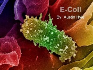 EColi By Austin Hyle Escherichia Coli The scientific