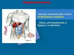 Esquistossomose Doena causada pelo verme Schistosoma mansoni Ataca