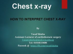 Chest xray HOW TO INTERPRET CHEST XRAY By