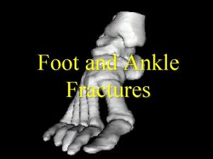 Foot and Ankle Fractures Anatomy Three groups of