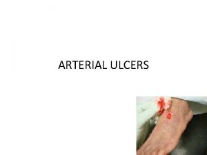 ARTERIAL ULCERS INTRODUCTION Arterial ulcers also referred to
