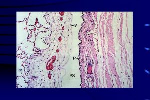 Pleure Richiami di base Pleura viscerale connettivo sottomesoteliale