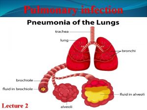 Pulmonary infection Lecture 2 Pulmonary infections Pneumonia Any