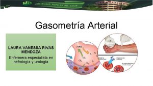 Gasometra Arterial LAURA VANESSA RIVAS MENDOZA Enfermera especialista