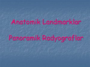 Anatomik Landmarklar Panoramik Radyograflar n Panoramik grntde izlenen