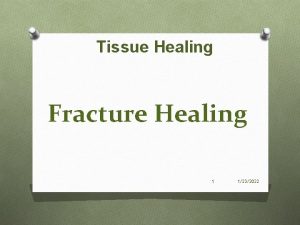 Tissue Healing Fracture Healing 1 1232022 Bellwork Take