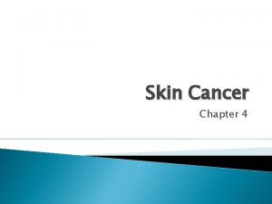 Skin Cancer Chapter 4 Types Basal Cell Carcinoma