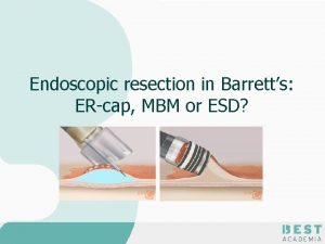 Endoscopic resection in Barretts ERcap MBM or ESD