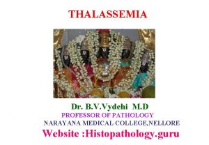THALASSEMIA Dr B V Vydehi M D PROFESSOR