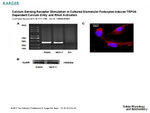 CalciumSensing Receptor Stimulation in Cultured Glomerular Podocytes Induces