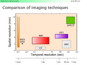 Magnetoencephalography Comparison of imaging techniques JongMo Seo Magnetoencephalography