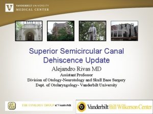 Superior Semicircular Canal Dehiscence Update Alejandro Rivas MD