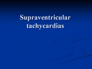 Supraventricular tachycardias n Definition tachycardia that originates from