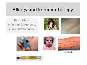 Allergy and Immunotherapy Peter Monk Infection Immunity p