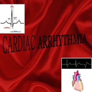 1 CLINICAL INCIDENCE 80 cardiac arrhythmia after M