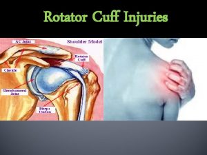 Rotator Cuff Injuries OBJECTIVES Anatomy of shoulder joint