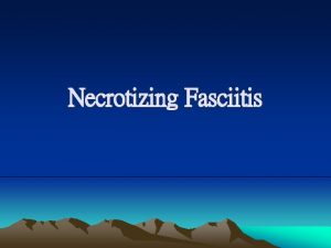 Necrotizing Fasciitis Clinical Features Systemic findings such as