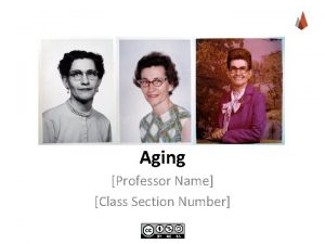 Aging Professor Name Class Section Number Overview Introduction