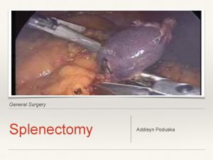 General Surgery Splenectomy Addisyn Poduska Relevant Anatomy Spleen