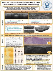 Linefield Optical Coherence Tomography of Basal Cell Carcinoma