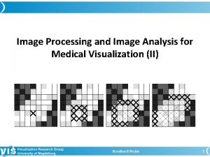 Image Processing and Image Analysis for Medical Visualization