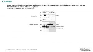 Renal Mesangial Cells Isolated from Sphingosine Kinase 2