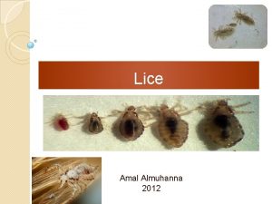 Lice Amal Almuhanna 2012 Order Phthiraptera lice Identification