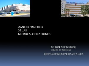 MANEJO PRACTICO DE LAS MICROCALCIFICACIONES DR RUGE DIAZ