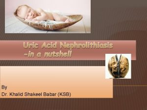 Uric Acid Nephrolithiasis in a nutshell By Dr