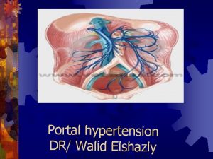 Portal hypertension DR Walid Elshazly Portal hypertension Portal