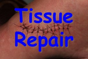 Tissue Repair Tissue Repair Wound healing Two ways