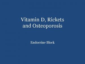 Vitamin D Rickets and Osteoporosis Endocrine Block Overview