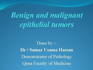 Benign and malignant epithelial tumors Done by Dr