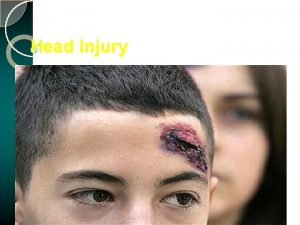 Head Injury Head Injury Head injury is a
