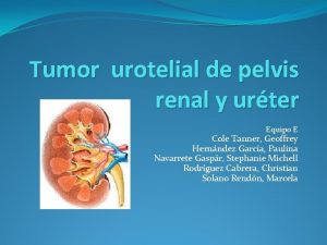 Tumor urotelial de pelvis renal y urter Equipo