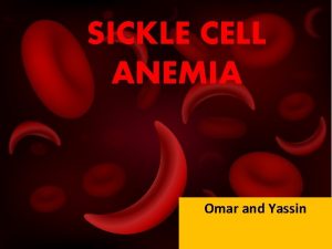 SICKLE CELL ANEMIA Omar and Yassin DEFINITION Sickle