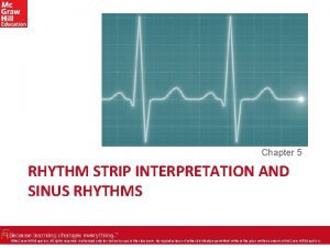 Chapter 5 RHYTHM STRIP INTERPRETATION AND SINUS RHYTHMS