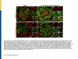 Fig 6 Double staining confirmed laminin 2 LAMB