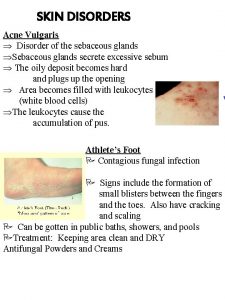 SKIN DISORDERS Acne Vulgaris Disorder of the sebaceous