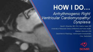 HOW I DO Arrhythmogenic Right Ventricular Cardiomyopathy Dysplasia