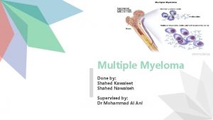 Multiple Myeloma Done by Shahed Kawaleet Shahed Nawaiseh Multiple Myeloma Done by Shahed Kawaleet Shahed Nawaiseh