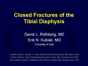 Closed Fractures of the Tibial Diaphysis David L