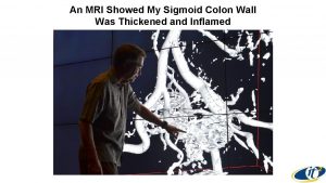 An MRI Showed My Sigmoid Colon Wall Was