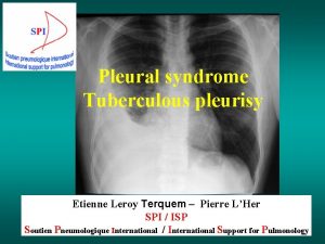 Pleural syndrome Tuberculous pleurisy Etienne Leroy Terquem Pierre