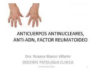 ANTICUERPOS ANTINUCLEARES ANTIADN FACTOR REUMATOIDEO Dra Roxana Blanco