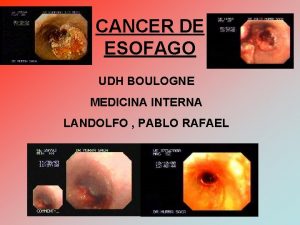 CANCER DE ESOFAGO UDH BOULOGNE MEDICINA INTERNA LANDOLFO