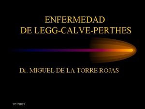 ENFERMEDAD DE LEGGCALVEPERTHES Dr MIGUEL DE LA TORRE