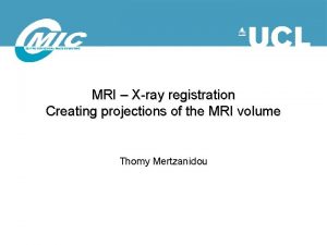 MRI Xray registration Creating projections of the MRI