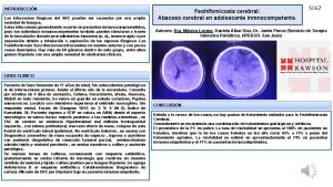 INTRODUCCIN Las infecciones fngicas del SNC pueden ser